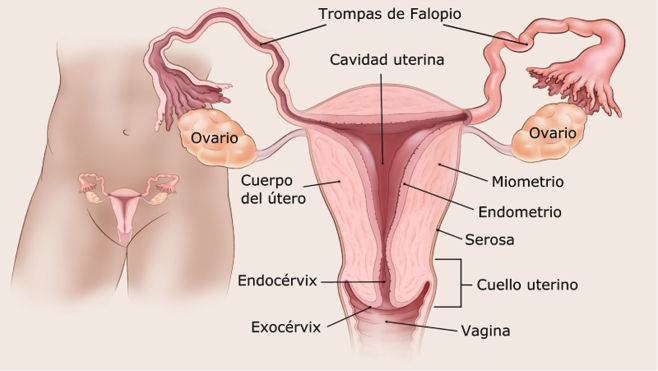 Qué es el sarcoma uterino? | Tipos de sarcoma uterino | American Cancer Society