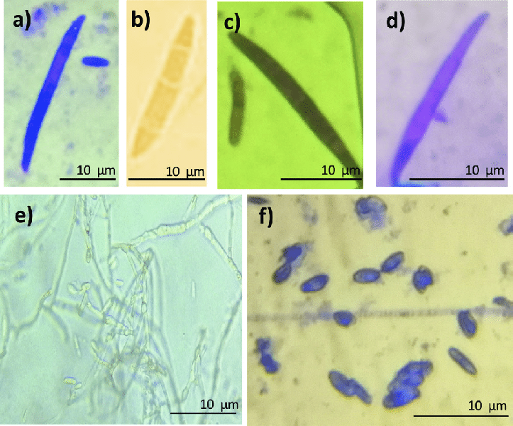 Estructuras morfológicas de Fusarium oxysporum en aumento inmersión (100x);  ad) micronidios, e) micelio, f) clamidiosporas.